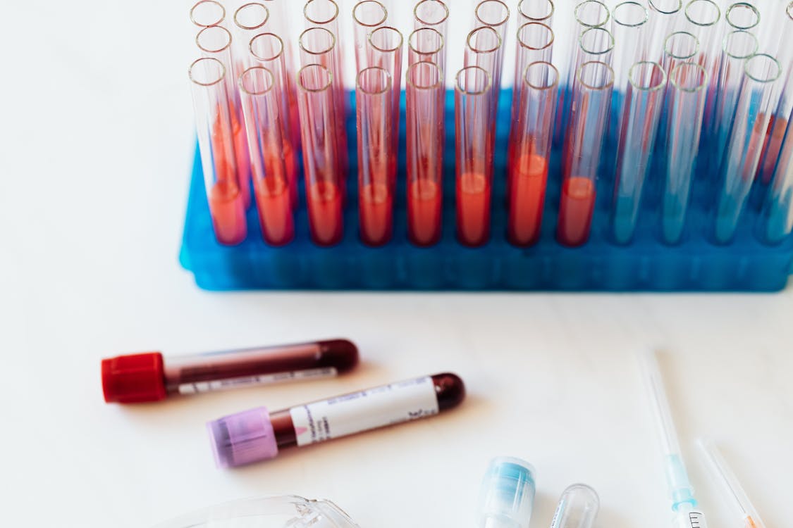 Blood test vials and tubes used in medical blood typing